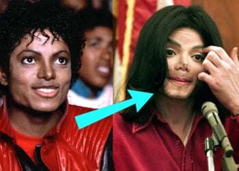Cosmetic Surgery