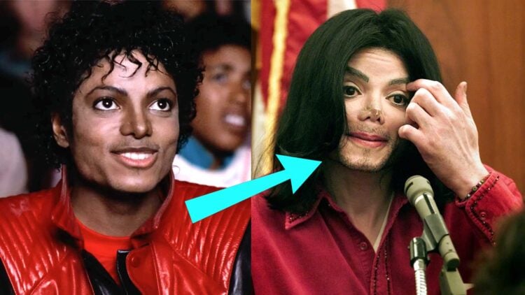 Cosmetic Surgery