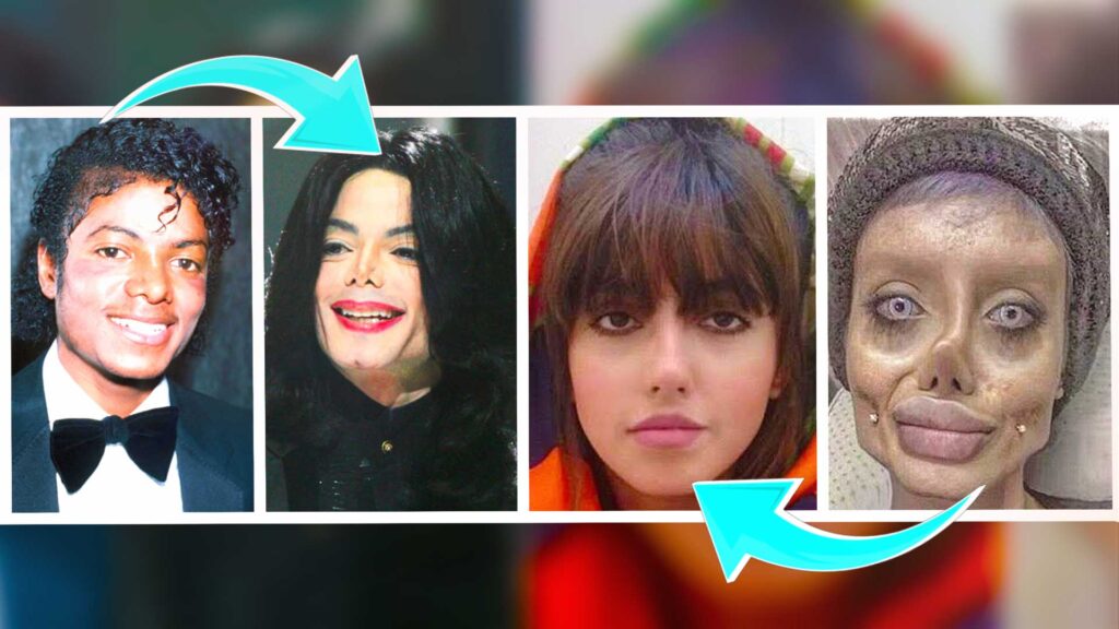 10 People Who Took Plastic Surgery Too Far Lifestyle Fortress