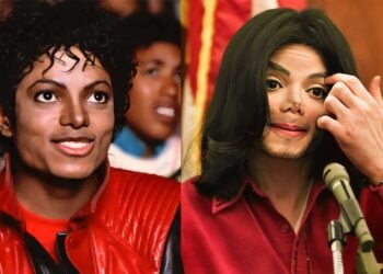 Before & After Gone Wrong When Plastic Surgery Pushes the Limit