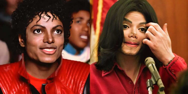 Before & After Gone Wrong When Plastic Surgery Pushes the Limit