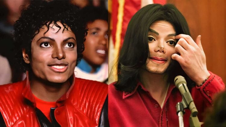 Before & After Gone Wrong When Plastic Surgery Pushes the Limit