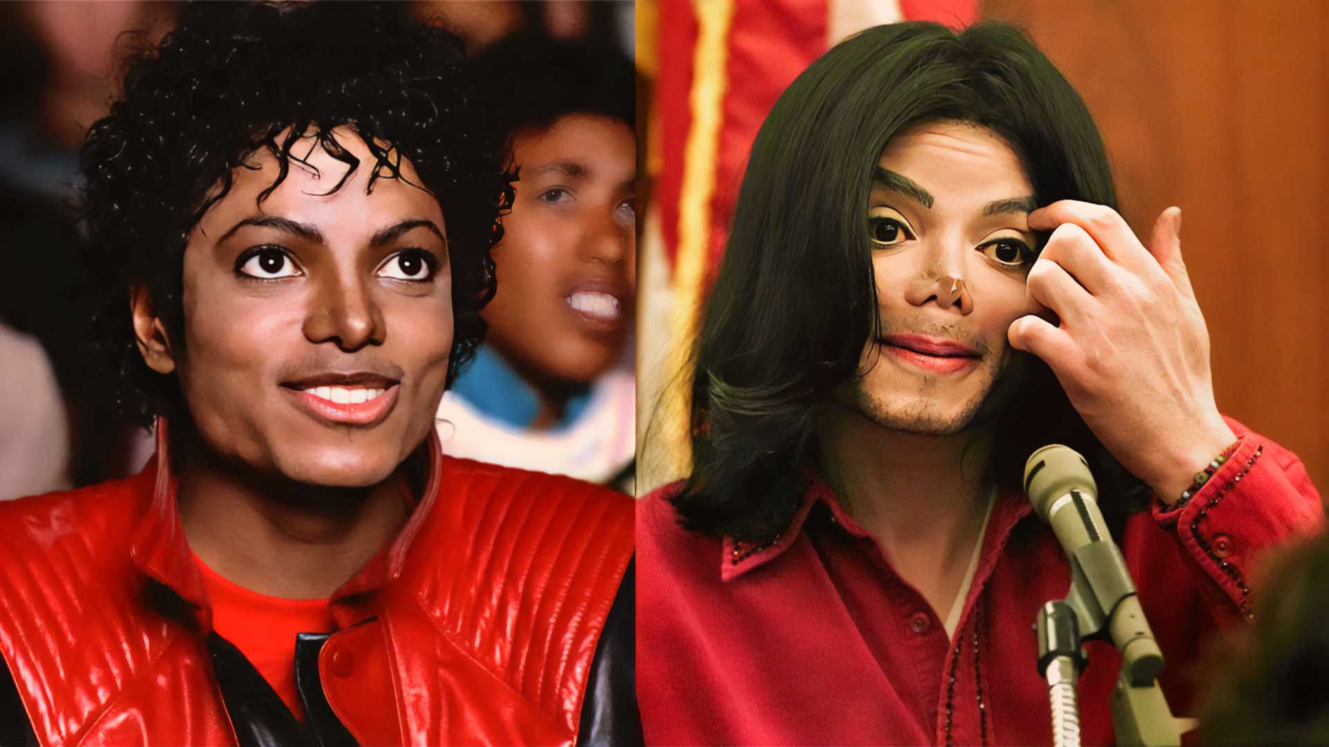 Before & After Gone Wrong When Plastic Surgery Pushes the Limit