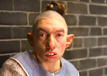 10 Actors Who Play Ugly Characters But Are Really Beautiful