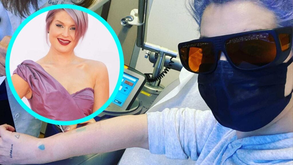 Kelly Osbourne tattoo removal