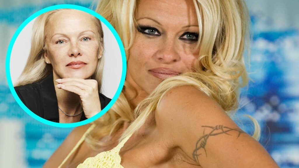 Pamela Anderson tattoo removal