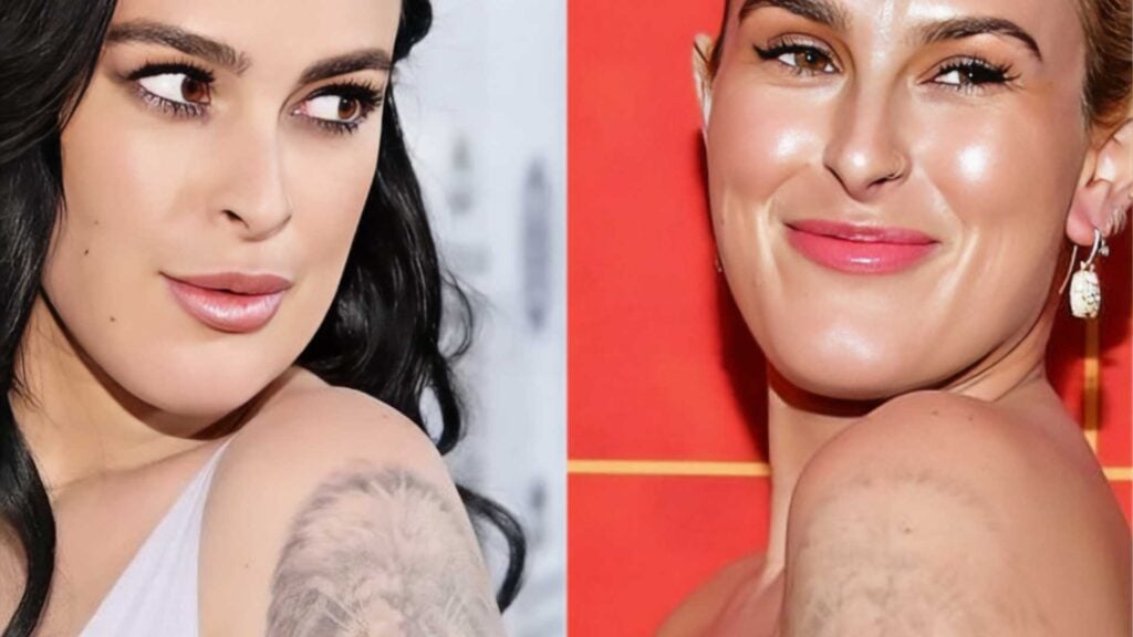 Rumer Willis tattoo removal