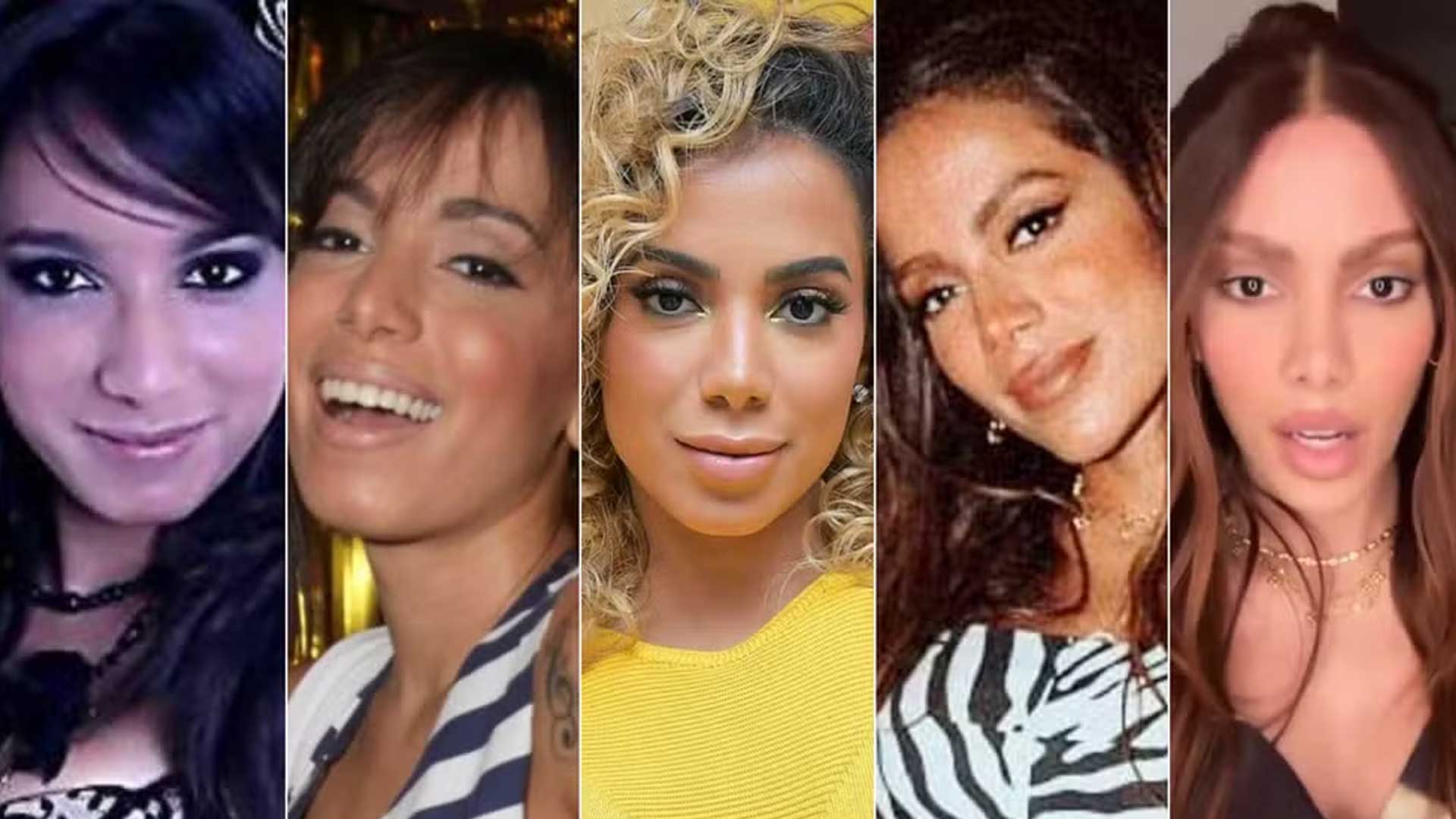 Anitta plastic surgery before and after