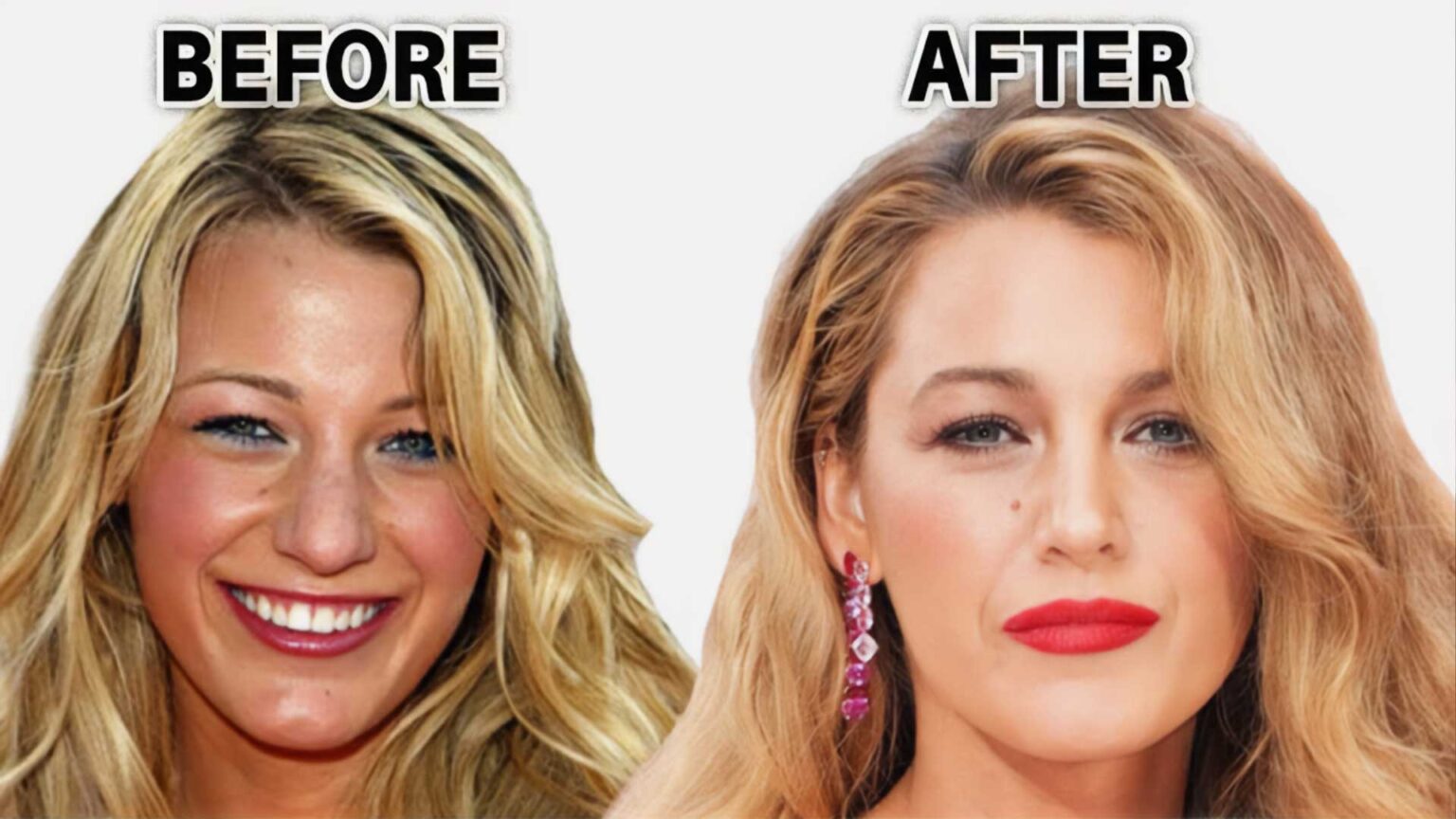 Hollywood Celebrity Plastic Surgery Transformations—The Best Looks and