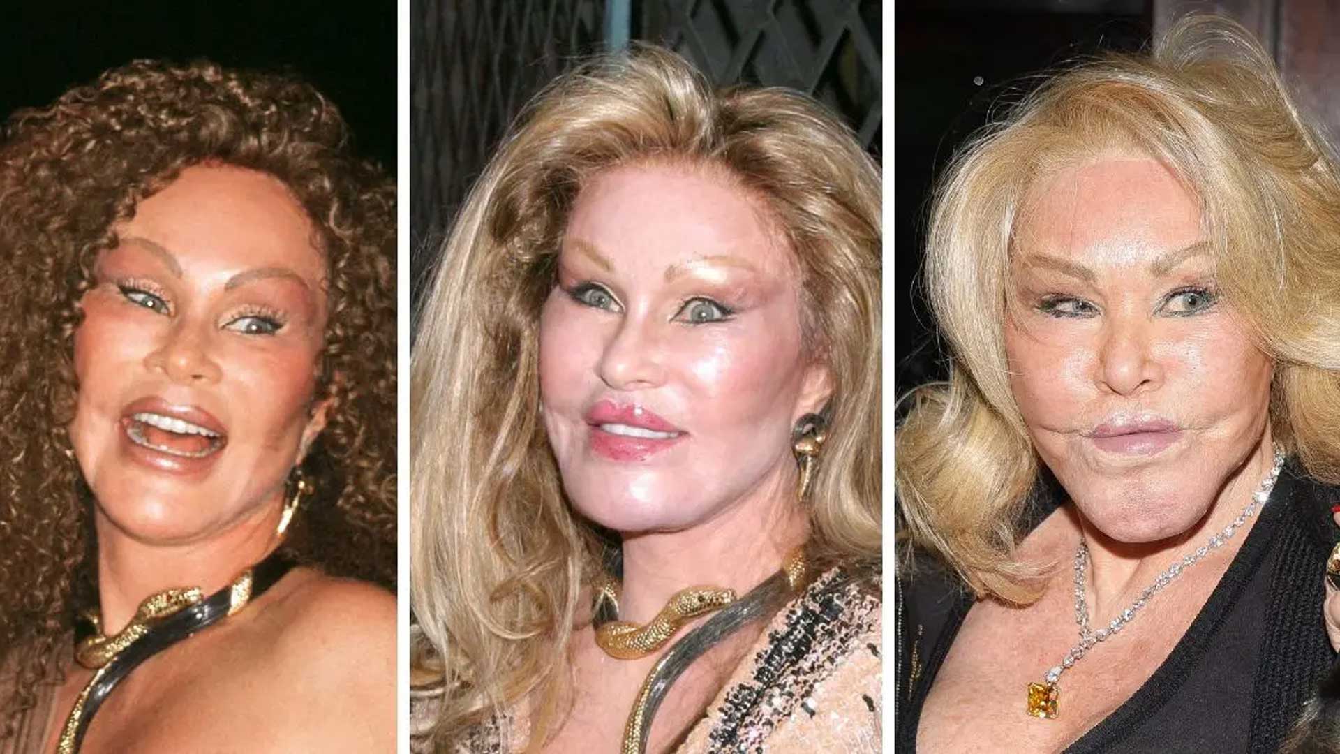 Jocelyn Wildenstein plastic surgery before and after