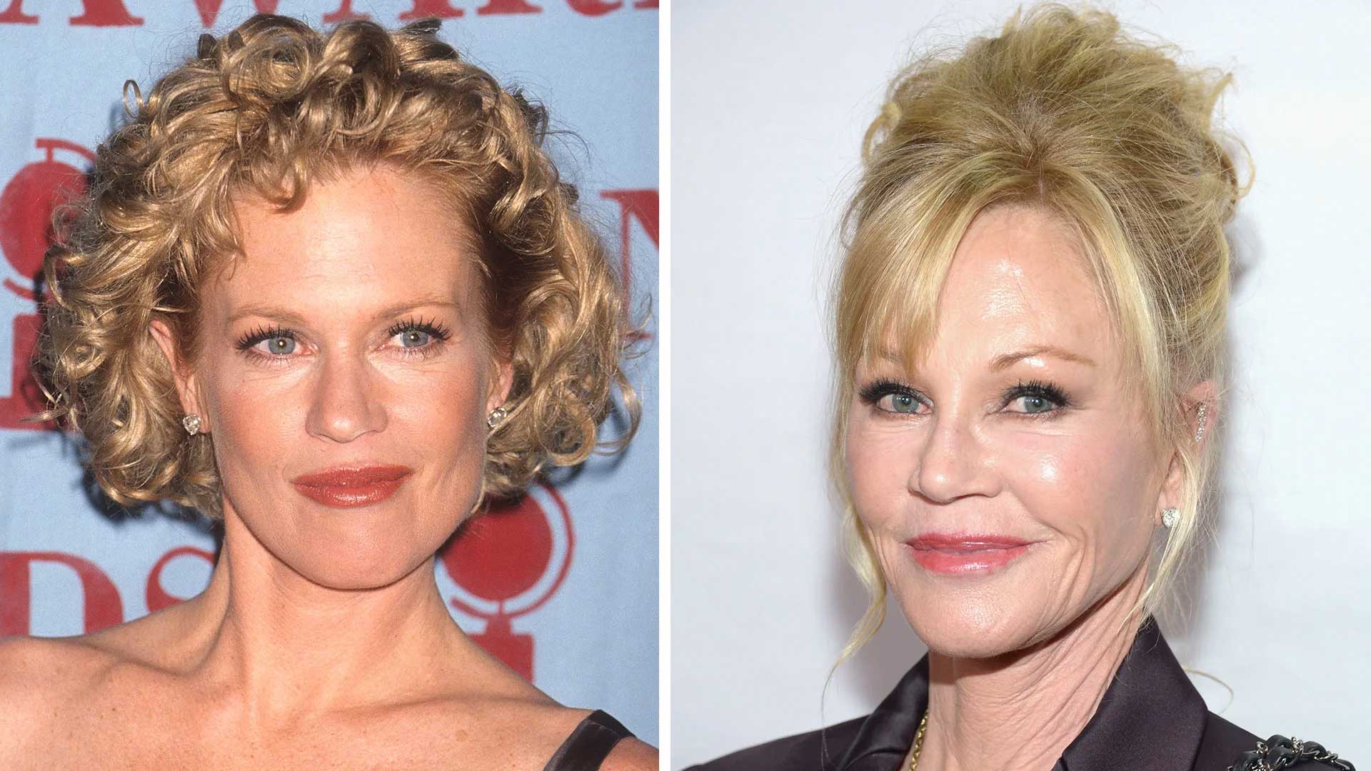 Melanie Griffith plastic surgery before and after