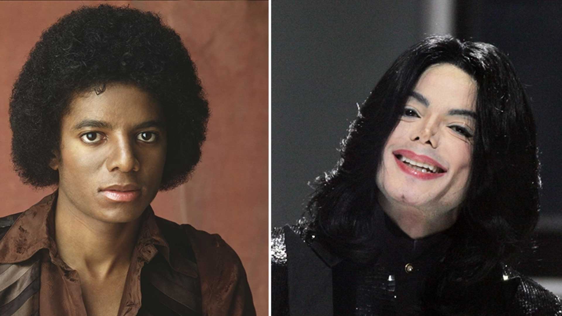 Michael Jackson plastic surgery before and after