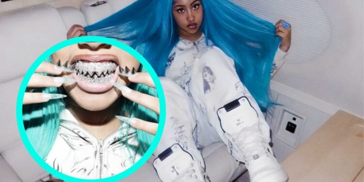 North West Flaunts Diamond Shark Grills on Instagram