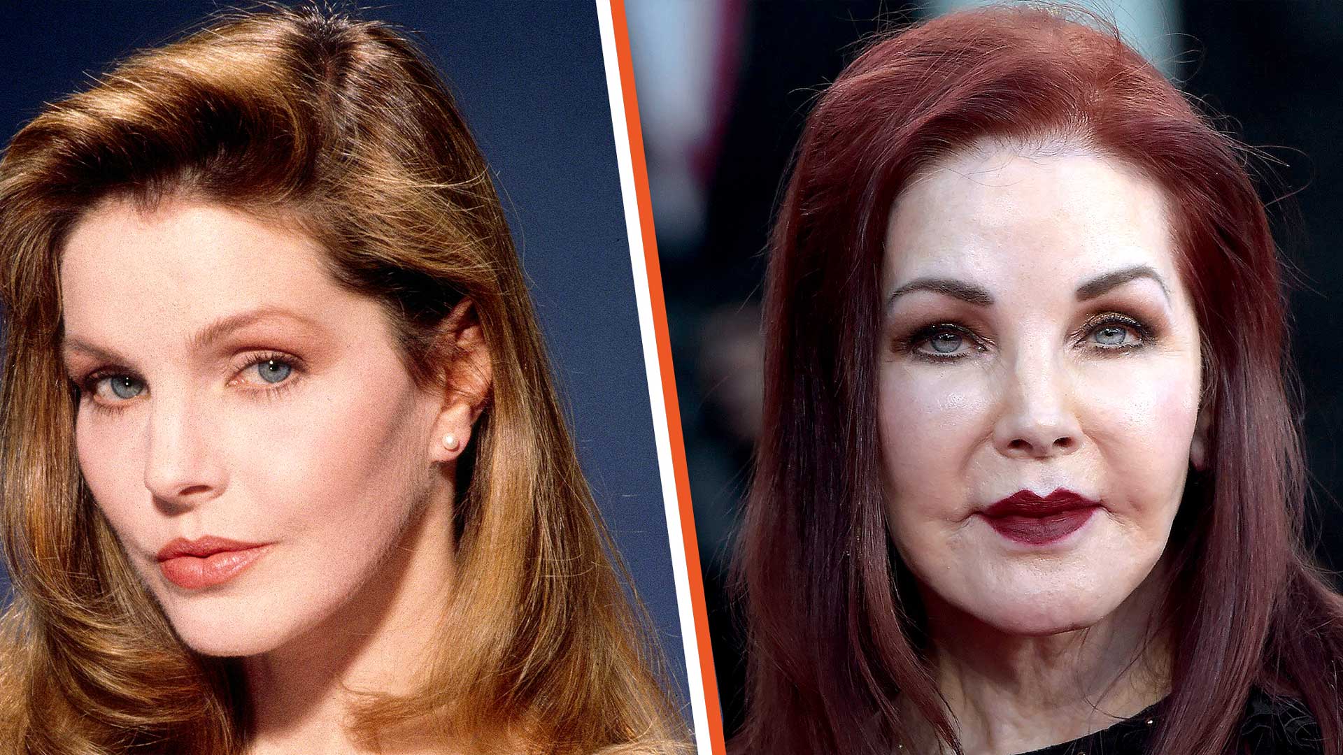 Priscilla Presley plastic surgery before and after